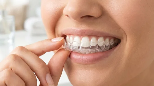 Ortodoncia Invisible vs. Brackets Tradicionales: ¿Cuál es mejor para ti?
